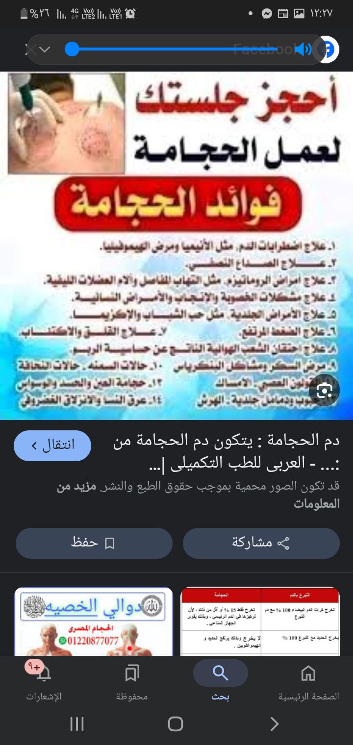 حجامة نبويه مكة