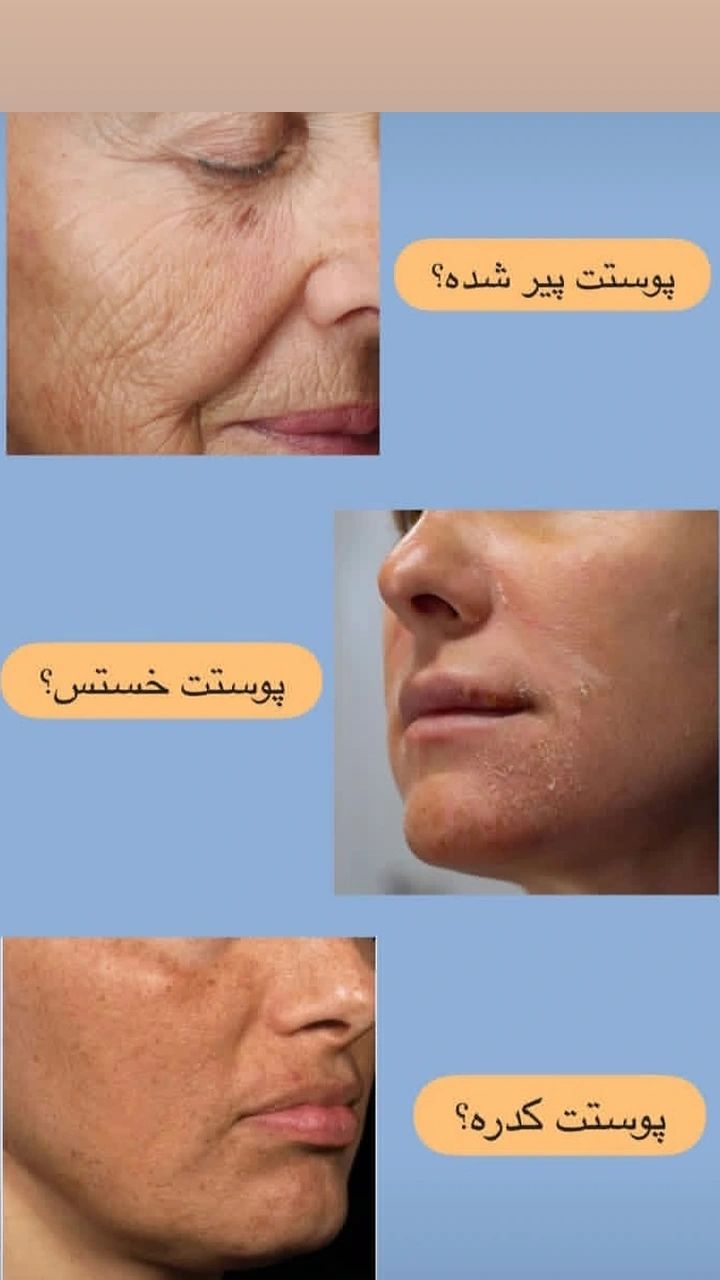 «علاج مشاكل البشرة